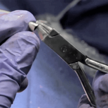 dental crown crimping - pediatric crown crimping crown dental procedure