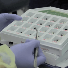 pediatric crown sizing procedure – dental crown procedure video