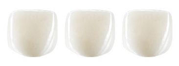 Zirconia Crowns Pediatric Dentistry – White Pediatric Dental Crowns