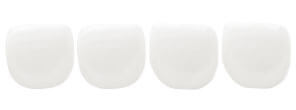 Pediatric Zirconia Crowns- Centrals