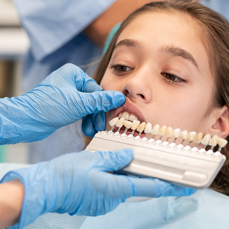 Shade guide for color matching pediatric dental crowns